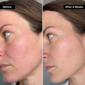 QRxLabs squalane oil texture close-up highlighting lightweight, non-greasy finish