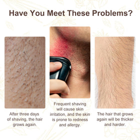 QRZBPZWE close-up dropper dispensing cyperus oil for precise application benefit