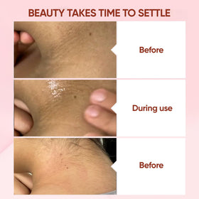 QUARXERY before and after scale comparison showing smoother skin