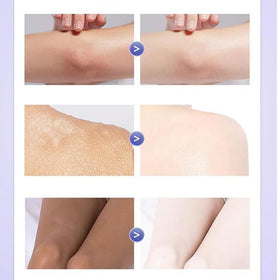 Quatrel cream texture close-up, showing smooth spreadability for fast absorption