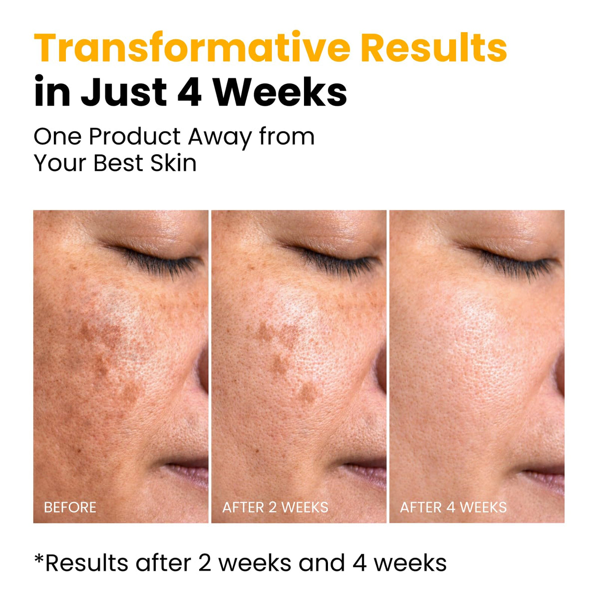 QUIA Beauty turmeric root highlighting antioxidant brightening benefits