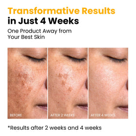 QUIA Beauty turmeric root highlighting antioxidant brightening benefits