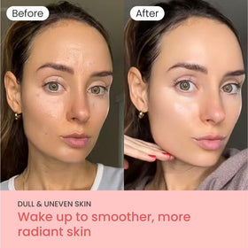 QUIA mask applied on model as overnight skincare ritual, improves skin
