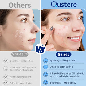 QUSTERE patch applied on cheek providing discreet blemish protection