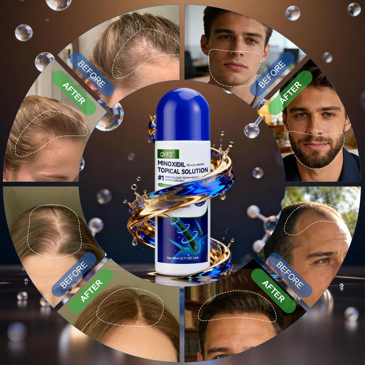 QYFJ serum being applied on scalp demonstrating targeted absorption benefit
