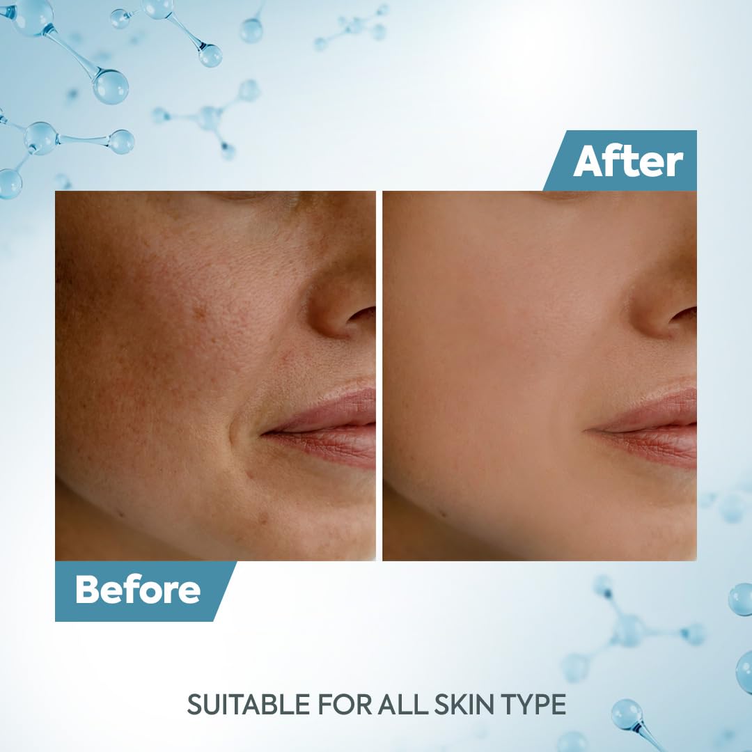 Raaga Professional application on arm illustrating easy de-tanning and visible results