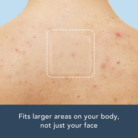 Rael patch on shoulder illustrating body-use coverage benefit