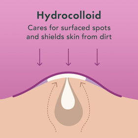 Rael patch applied to cheek illustrating overnight coverage and blemish shield