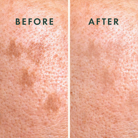 Rael patch adhered to skin demonstrating protection and targeted delivery
