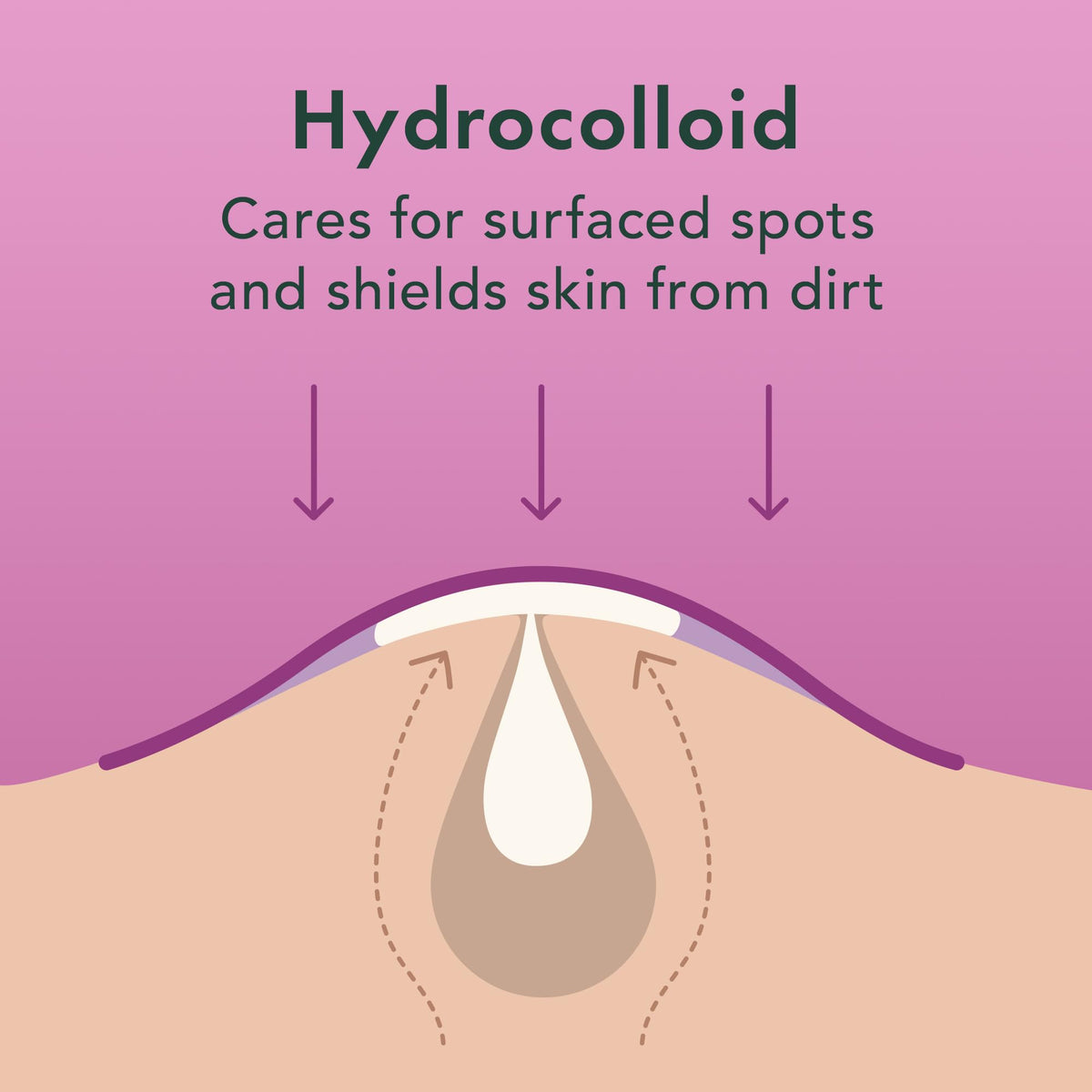 Rael hydrocolloid texture close-up, showing absorbent material advantage