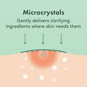Rael hydrocolloid texture detail illustrating absorbent surface benefit