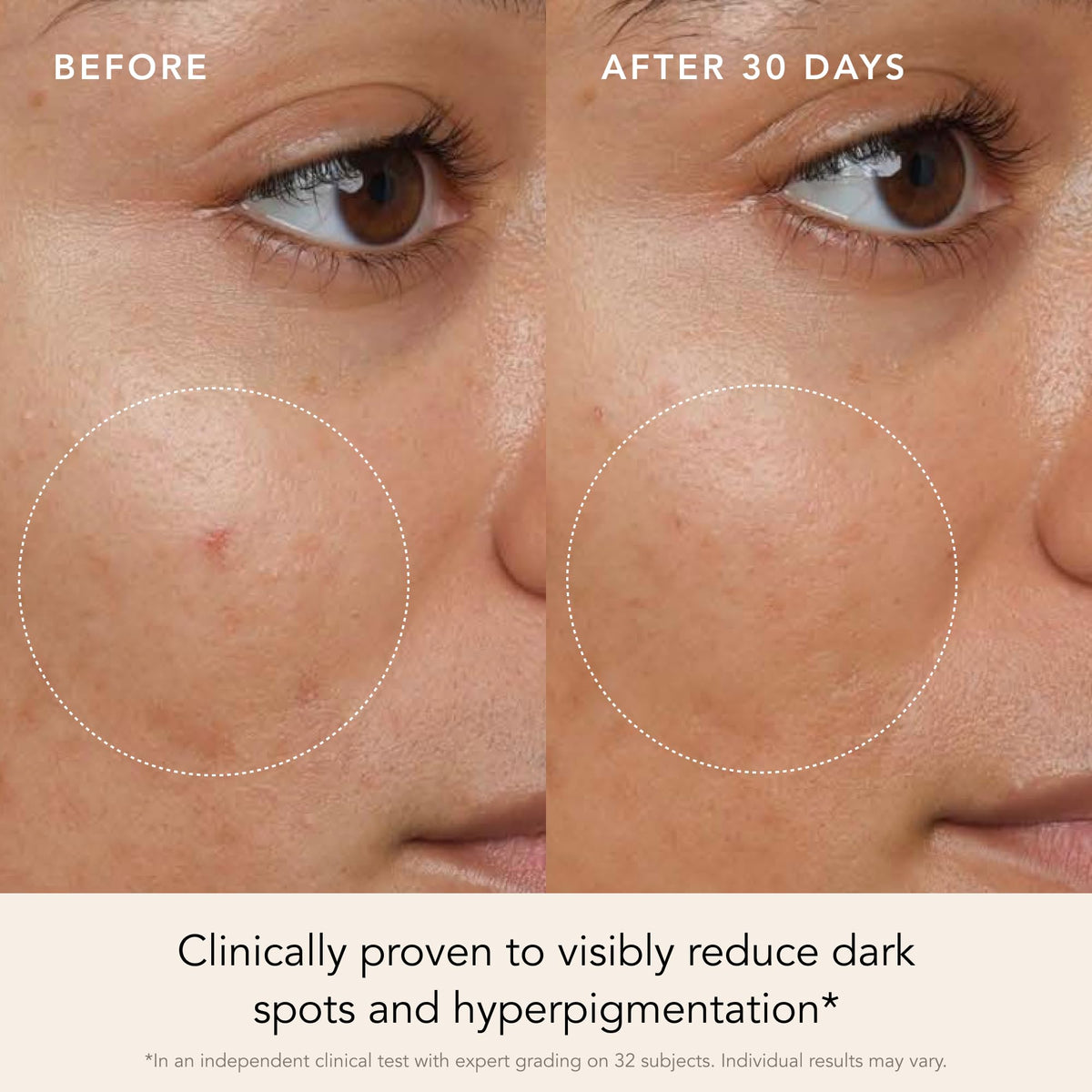 RANAVAT BOTANICS dropper dispensing serum over hand for precise application