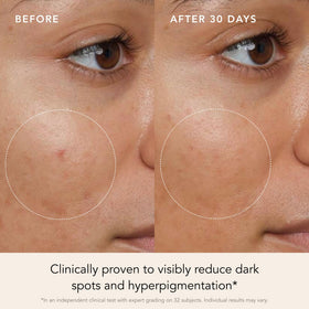 RANAVAT BOTANICS dropper dispensing serum over hand for precise application