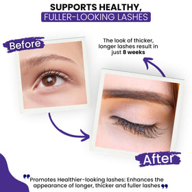 RapidLash 3 mL bottle beside a ruler to show compact travel size