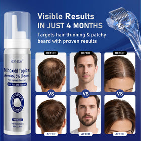 RDVHDLW foam texture on finger highlighting fast-absorbing, non-greasy benefit