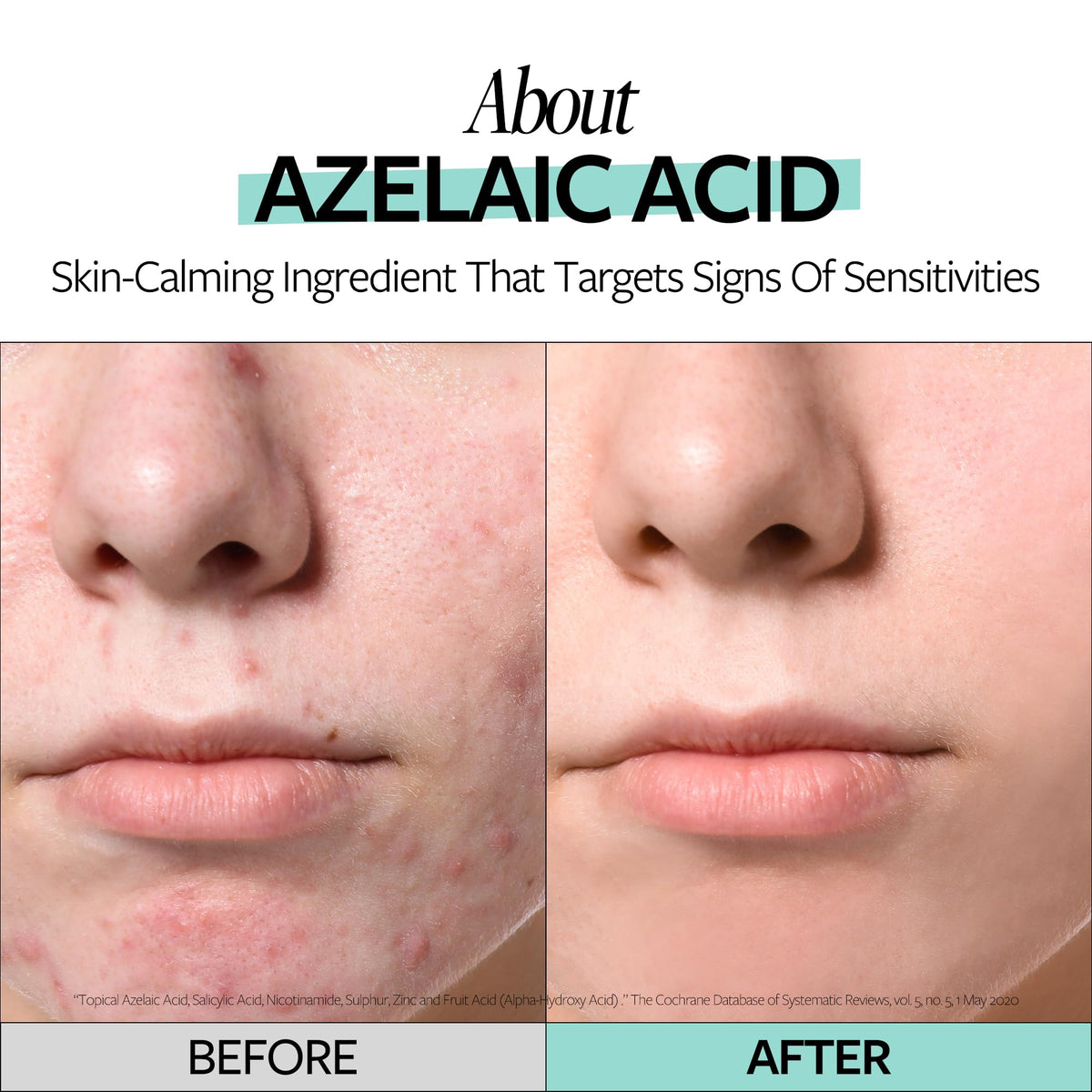 RE:CIPE ampoule held in hand to show 1.01 fl oz size and travel-friendly benefit