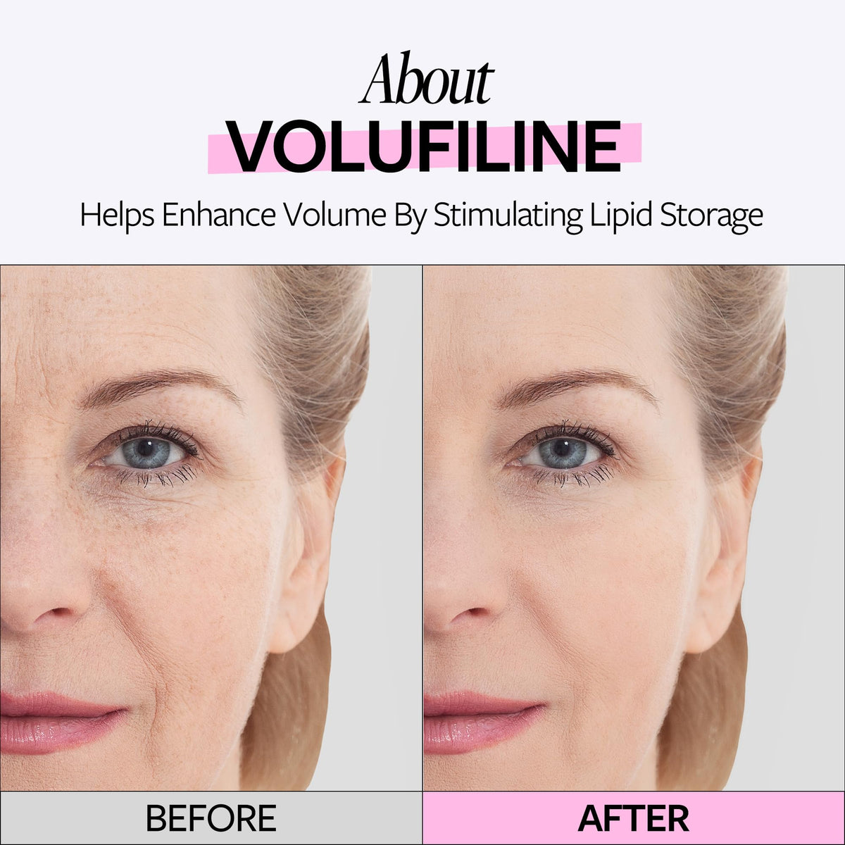 RE:CIPE Volufiline applied to cheek showing targeted plumping benefit