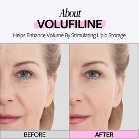 RE:CIPE Volufiline applied to cheek showing targeted plumping benefit