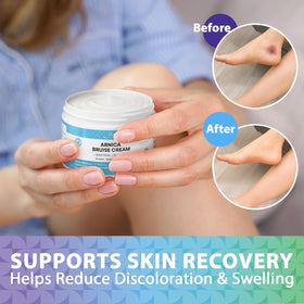 Recuren Plus applied to facial area demonstrating gentle care benefit