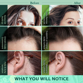 Recuren Plus applied to scalp in shower showing grease and flake reduction