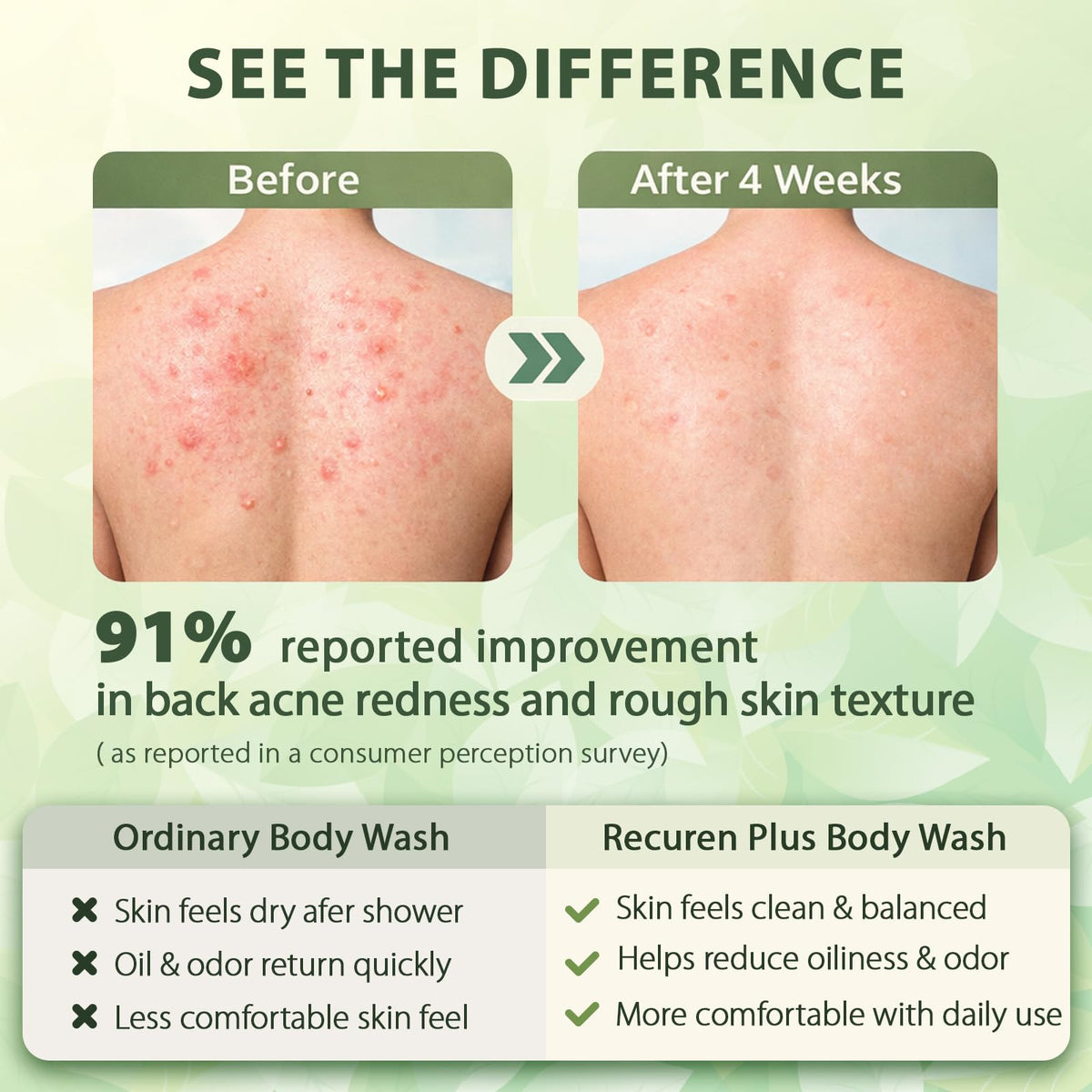 Recuren Plus used in shower on back acne area for targeted cleansing