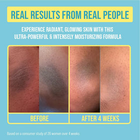 Red by Kiss cream being applied to back demonstrating pore-clarifying benefit