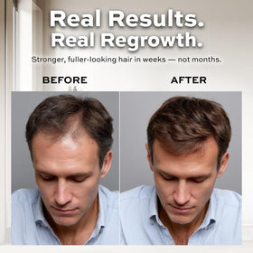REFORIAN castor oil ingredient visual emphasizes nourishing support for strands