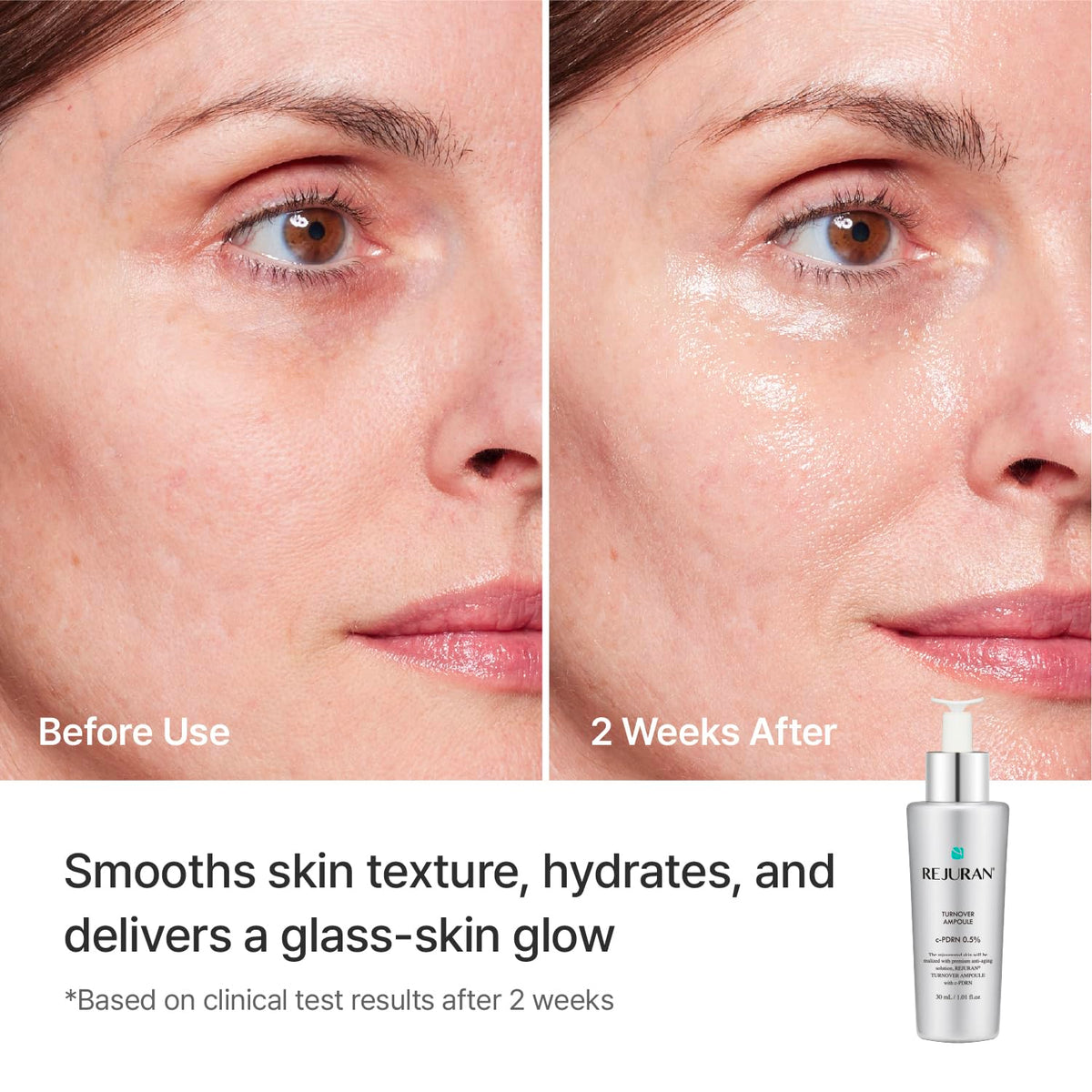 REJURAN ampoule being applied to face demonstrating targeted use and smoother look