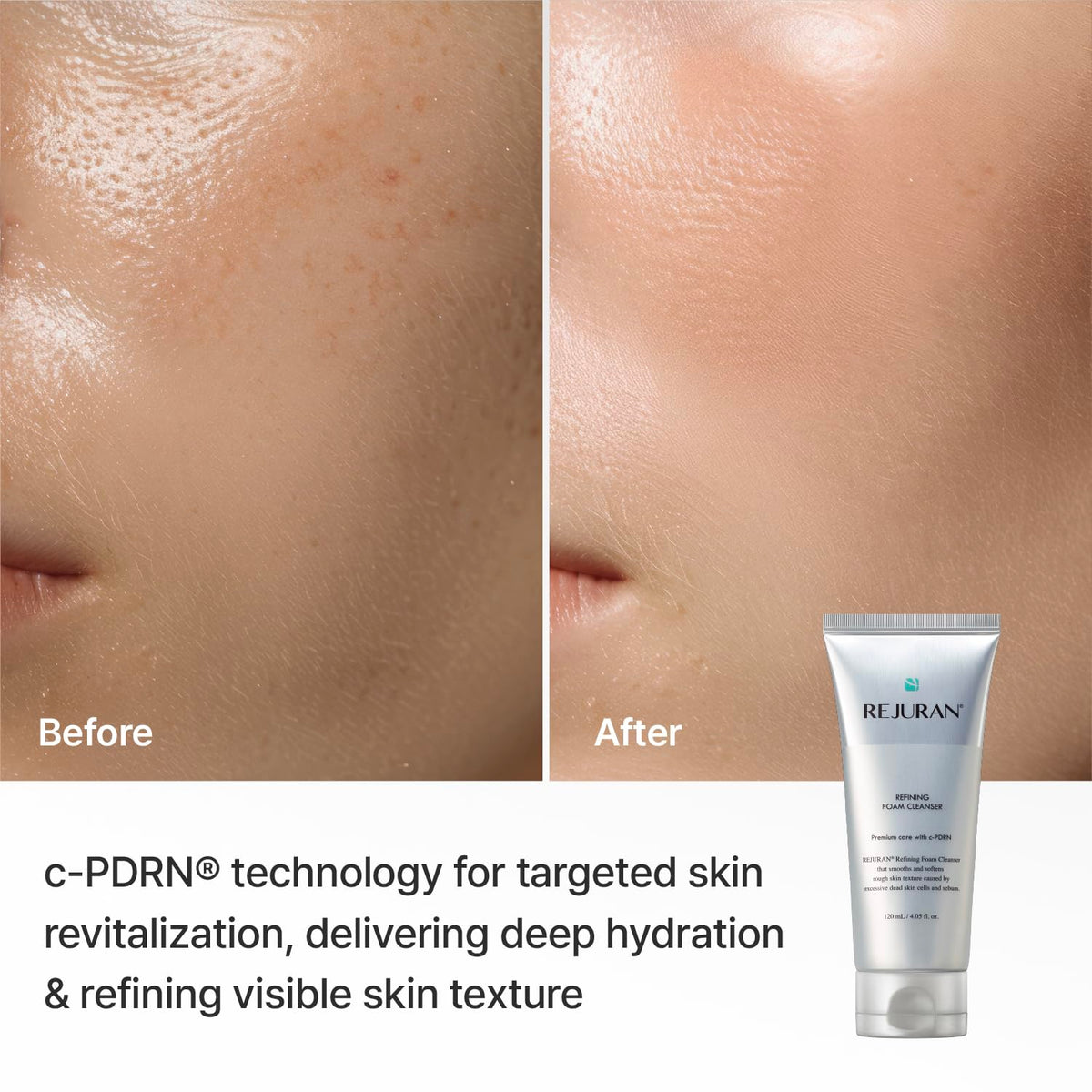 REJURAN foam on hand illustrating soft lather and hydrating finish