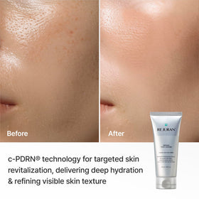 REJURAN foam on hand illustrating soft lather and hydrating finish