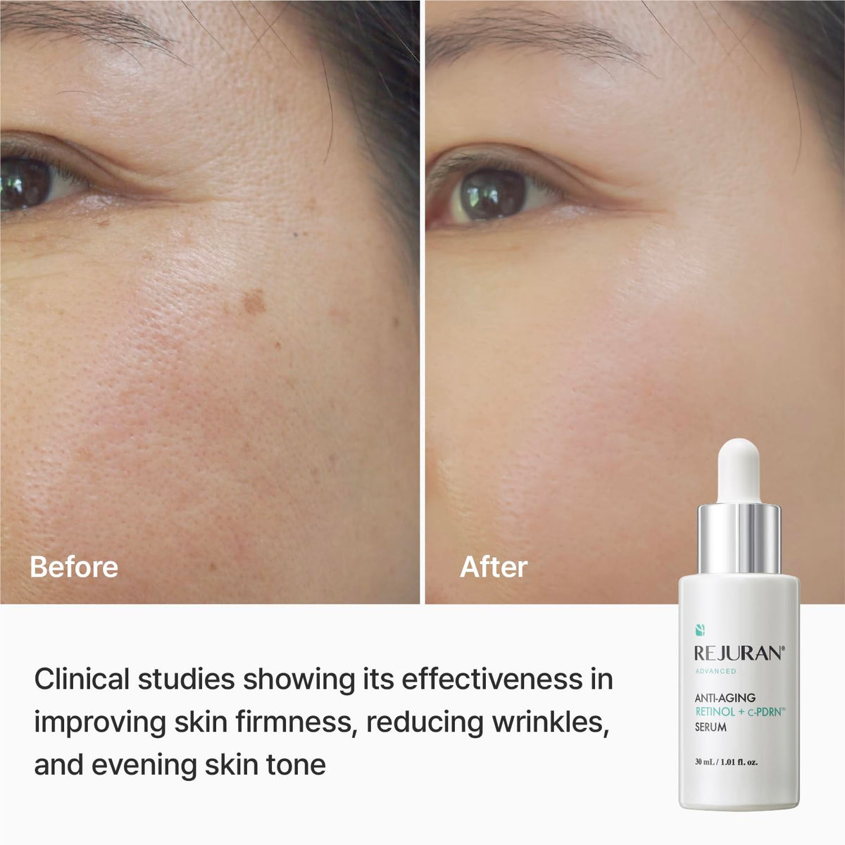 REJURAN c-PDRN ingredient vial illustrating regenerative technology benefit