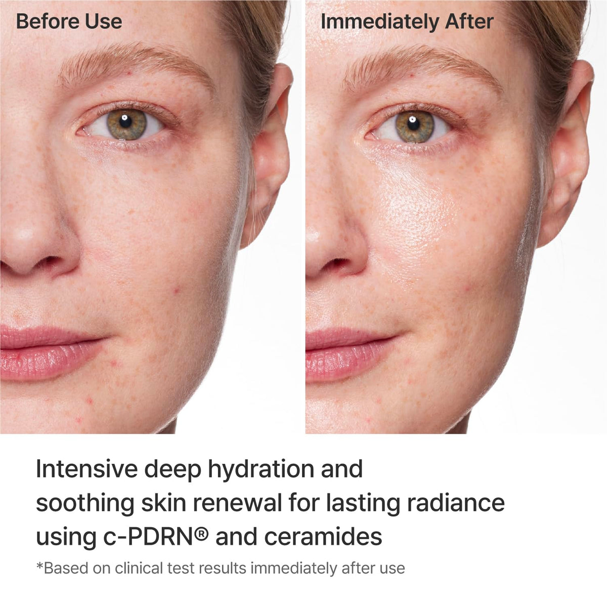 REJURAN sheet mask worn by model providing soothing hydration