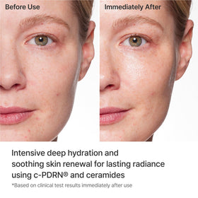 REJURAN sheet mask worn by model providing soothing hydration