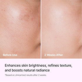 REJURAN dropper dispensing serum to illustrate controlled application benefit