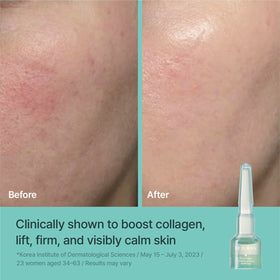 REJURAN serum texture applied on skin demonstrating fast absorption and hydration