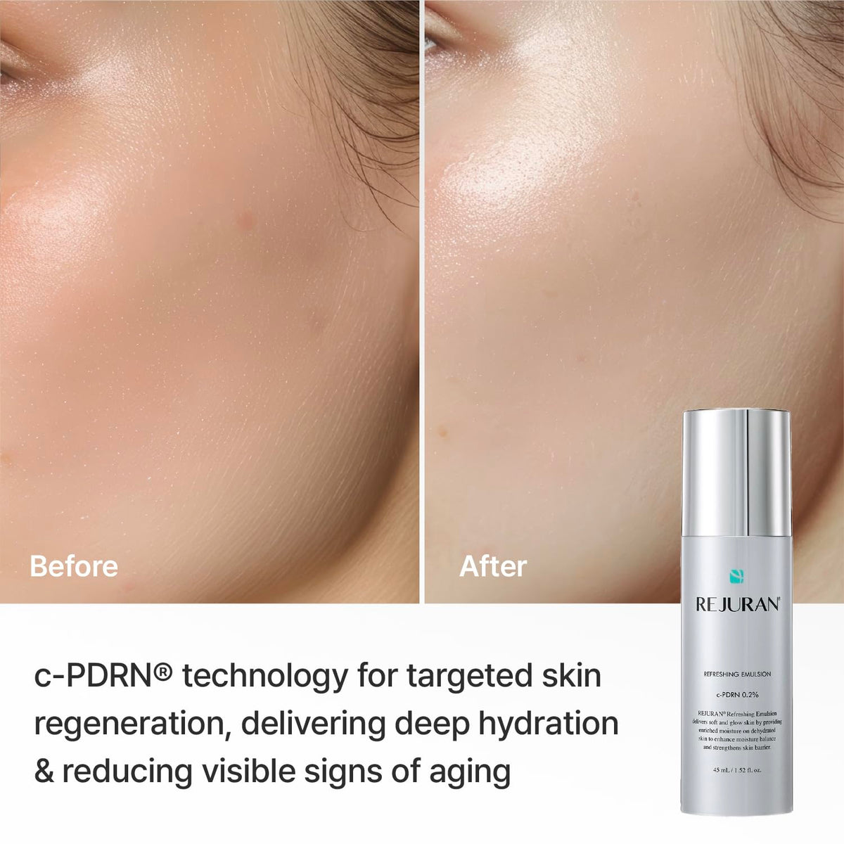 REJURAN ingredient label close-up, emphasizes c-PDRN and clean formula