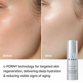 REJURAN ingredient label close-up, emphasizes c-PDRN and clean formula