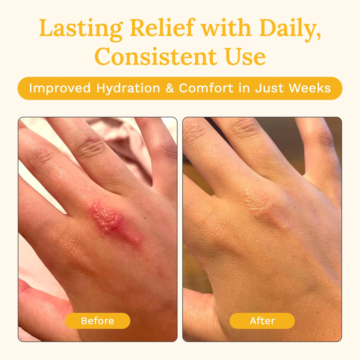 Rejuvaskin label with National Eczema Association seal indicating gentle, approved formula