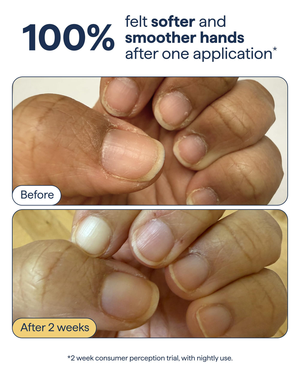 Remedy applying cream to hands demonstrating quick hydration benefit