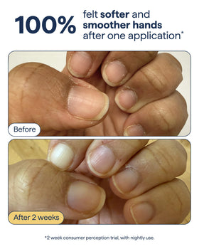 Remedy applying cream to hands demonstrating quick hydration benefit