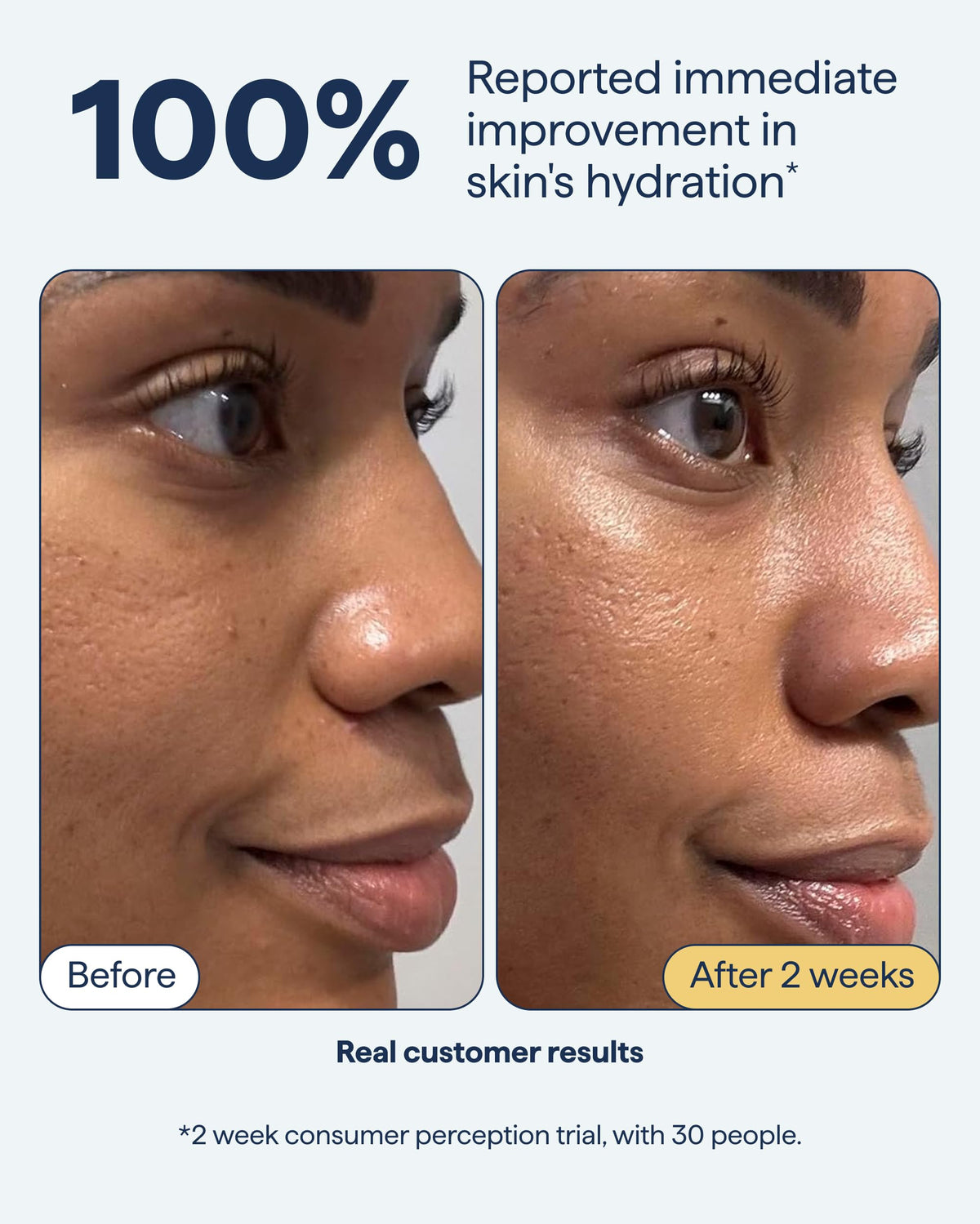 Remedy Science cream being applied on hand demonstrating quick absorption and softening
