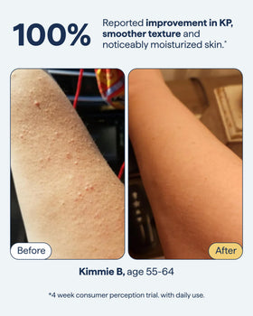Remedy Science ingredient callout with retinol, urea, lactic acid identified