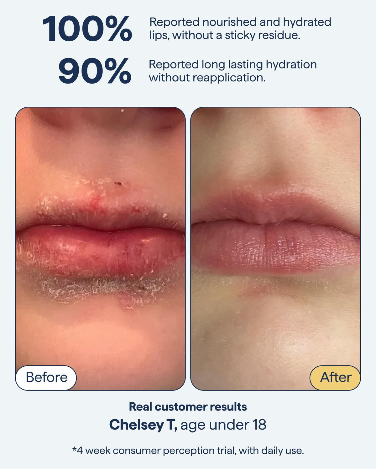 Remedy Science arranged ingredients ceramides peptides squalane for efficacy