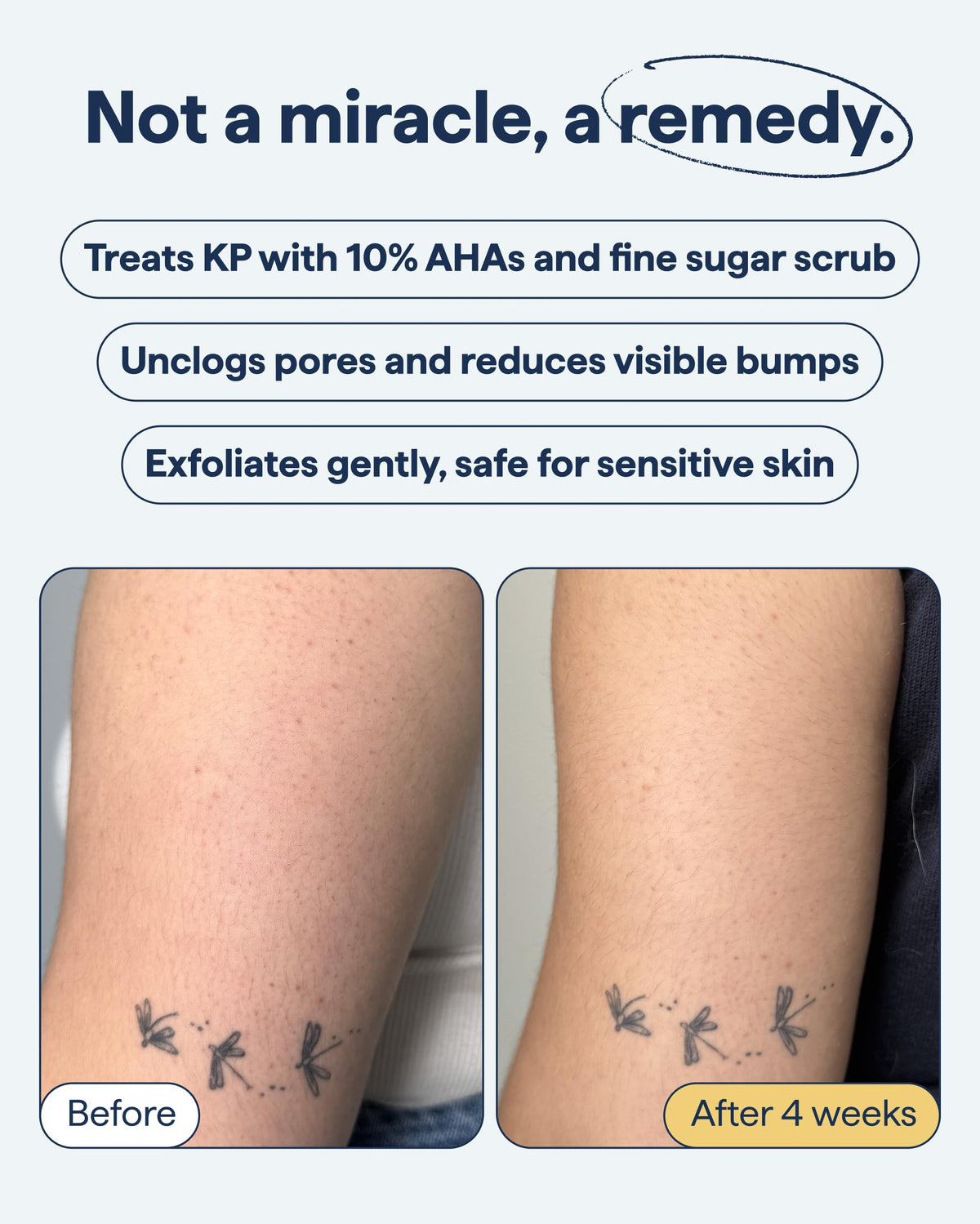 Remedy Science product in shower being used on upper arm for bumps