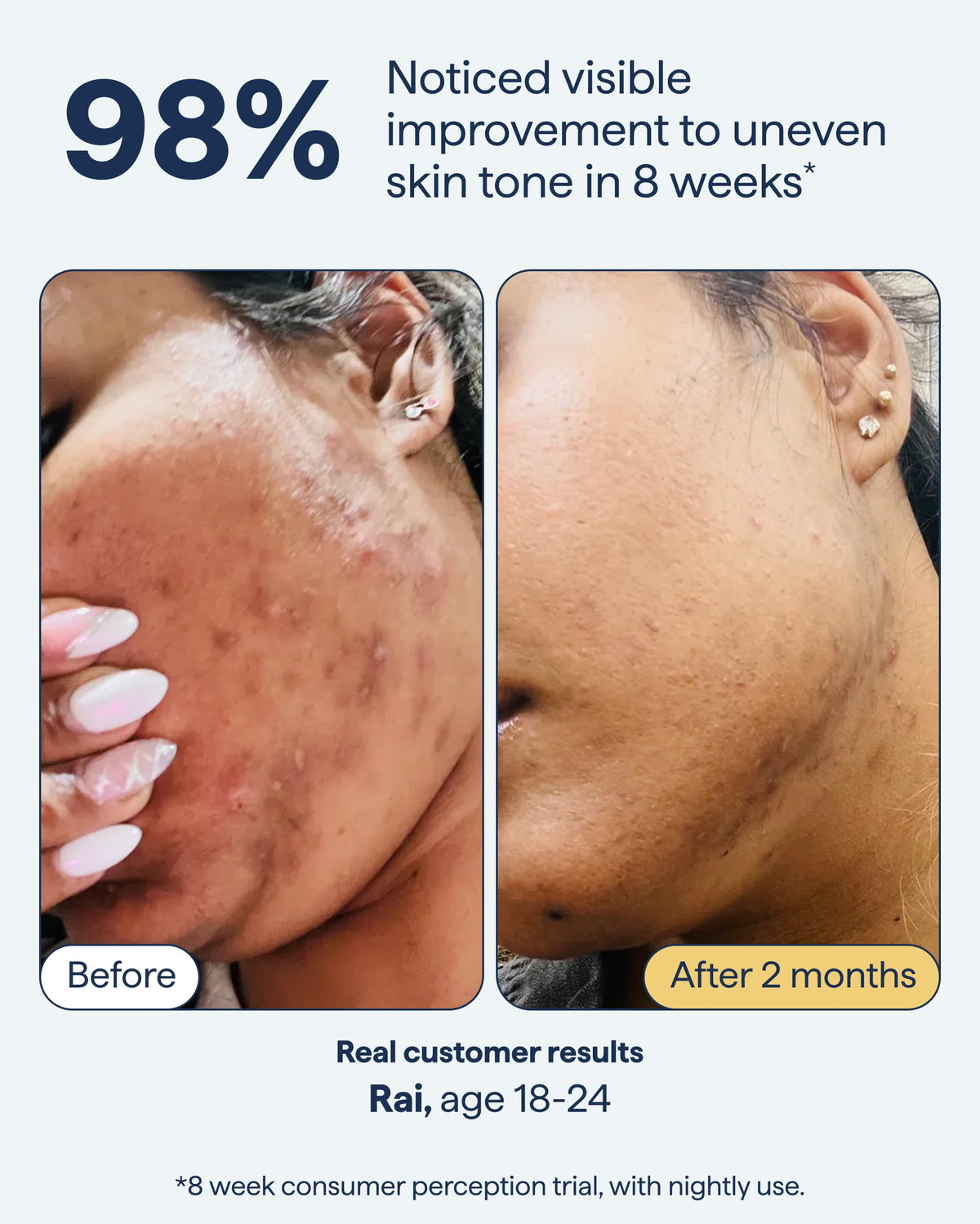 Remedy Science positioned in nighttime skincare setup, integrates into evening routine benefit