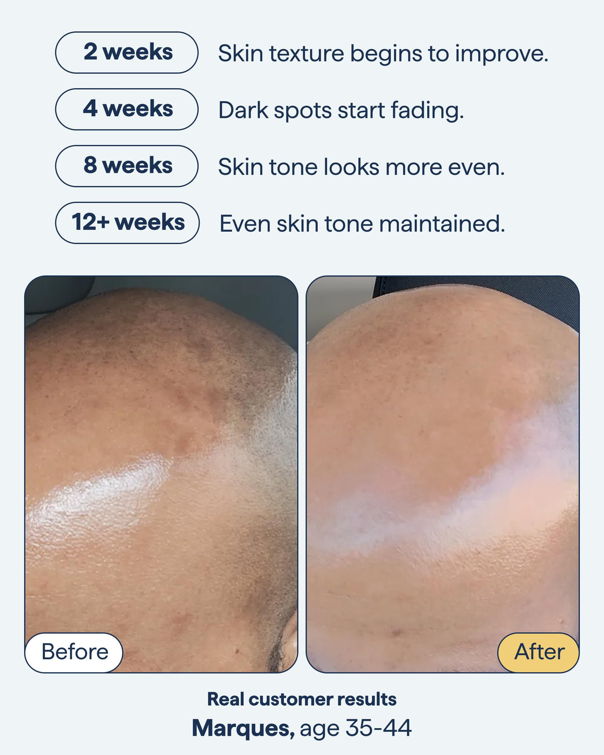 Remedy Science gel texture dispensed on fingertip, fast‑absorbing feel demonstrated