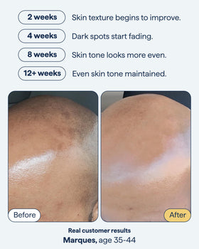 Remedy Science gel texture dispensed on fingertip, fast‑absorbing feel demonstrated