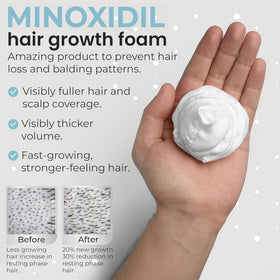 Rida Hair Research Institute remixidil in-use application on scalp for targeted treatment