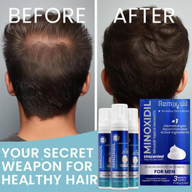 Rida Hair Research Institute remixidil lifestyle bathroom counter showing everyday routine