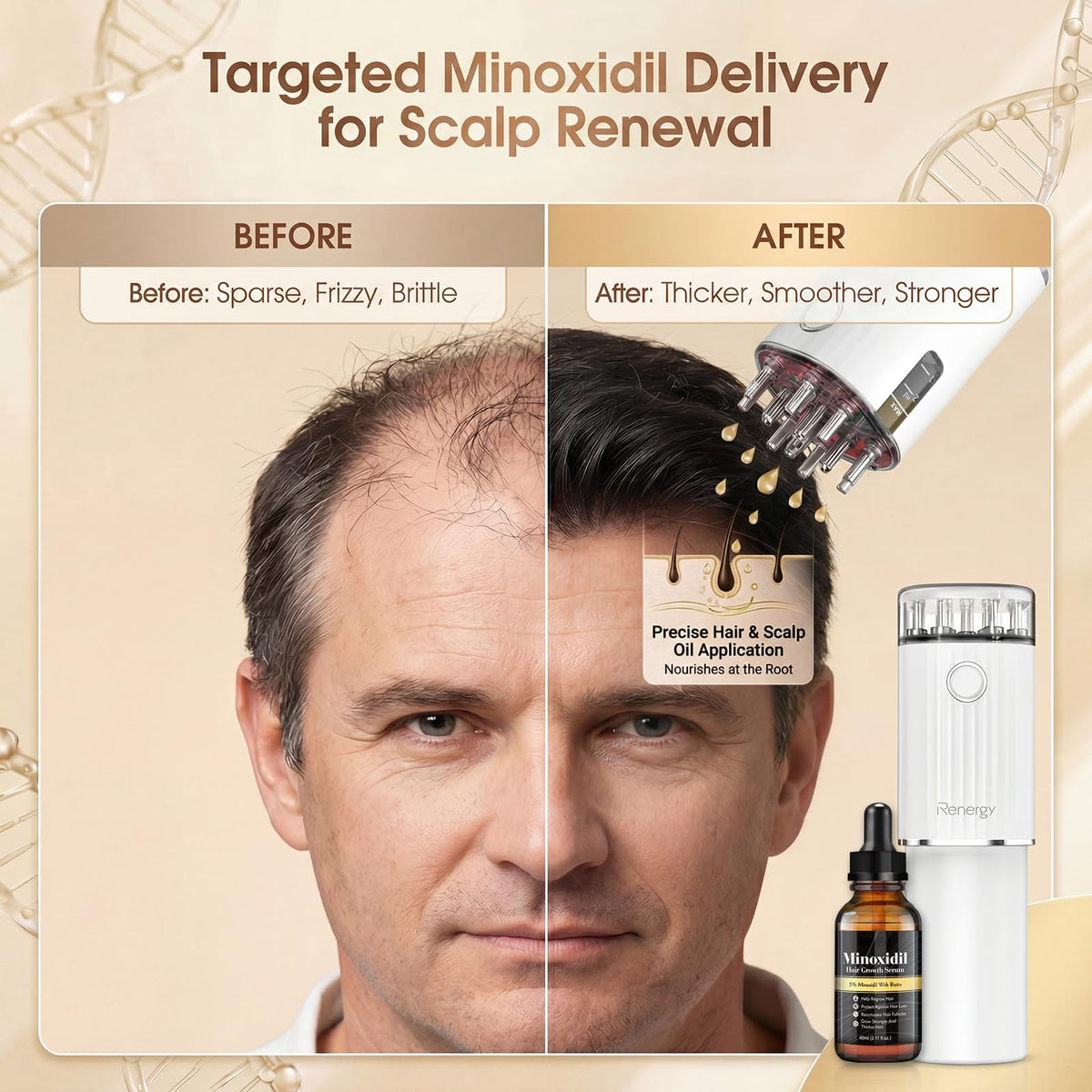 Renergy visible dosing scale detail for accurate serum measurement and control